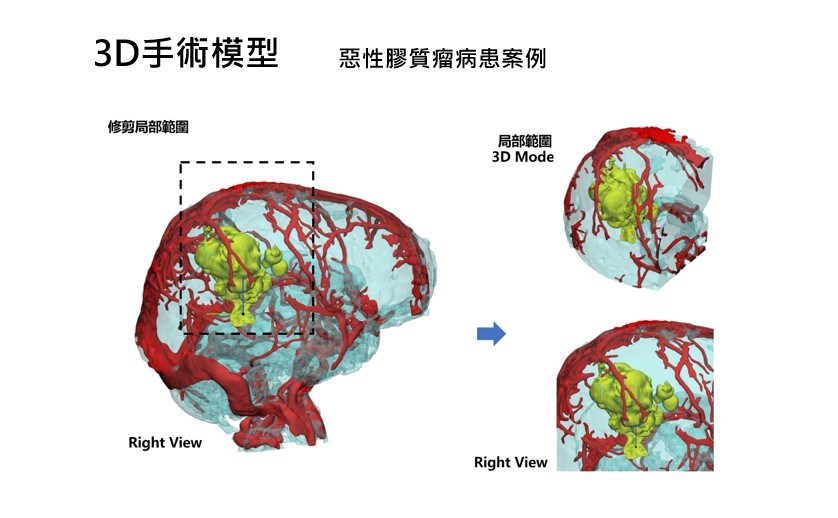 手術模型