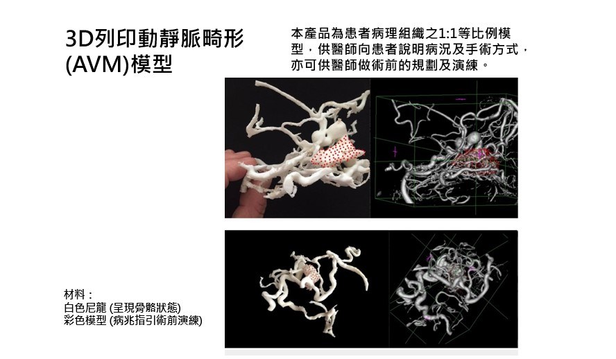 手術模型
